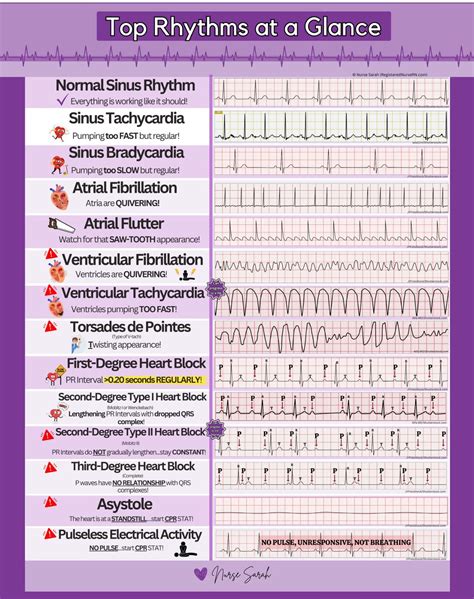 The Foundational Blocks: Notes, Rhythms, and Basic Notation